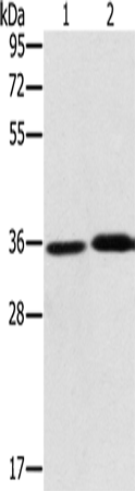 Anti-PHYH Rabbit Polyclonal Antibody