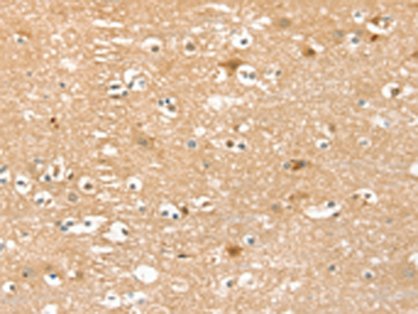 Anti-PIN1 Rabbit Polyclonal Antibody