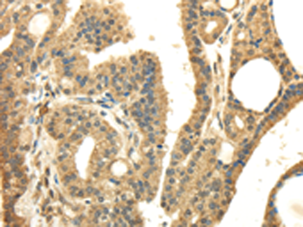 Anti-PMP2 Rabbit Polyclonal Antibody
