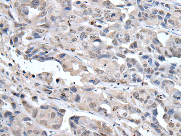 Anti-POT1 Rabbit Polyclonal Antibody