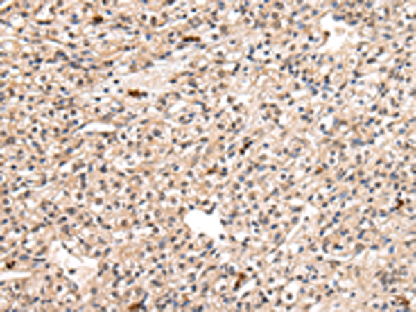 Anti-PPIL1 Rabbit Polyclonal Antibody