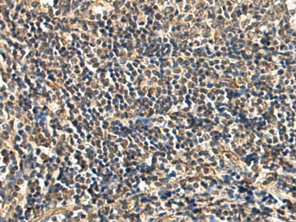 Anti-PDP1 Rabbit Polyclonal Antibody