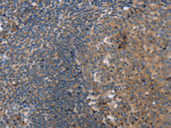 Anti-PPP2R3C Rabbit Polyclonal Antibody