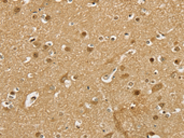 Anti-PSMC1 Rabbit Polyclonal Antibody