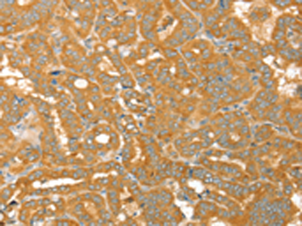 Anti-PTPN22 Rabbit Polyclonal Antibody