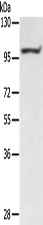 Anti-PTPN22 Rabbit Polyclonal Antibody