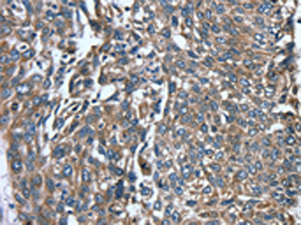 Anti-BIT1 Rabbit Polyclonal Antibody