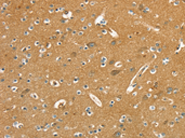 Anti-PYGL Rabbit Polyclonal Antibody