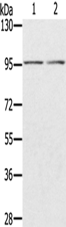 Anti-PYGL Rabbit Polyclonal Antibody