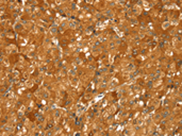 Anti-PYGM Rabbit Polyclonal Antibody