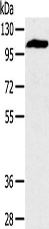 Anti-PYGM Rabbit Polyclonal Antibody