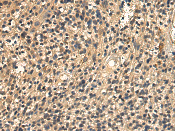 Anti-Rab3A Rabbit Polyclonal Antibody