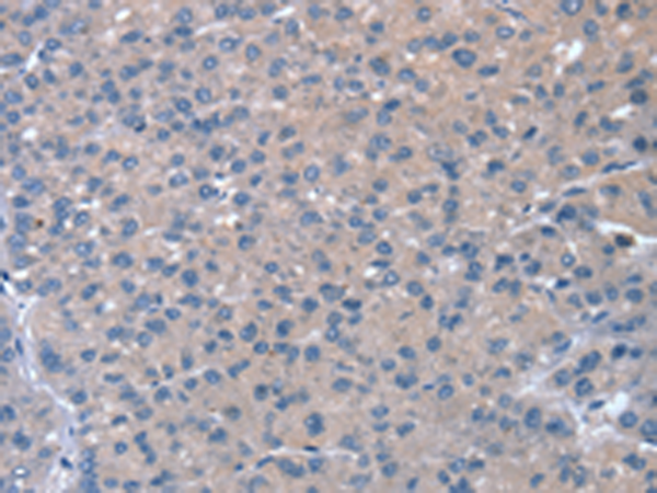 Anti-RASA4 Rabbit Polyclonal Antibody