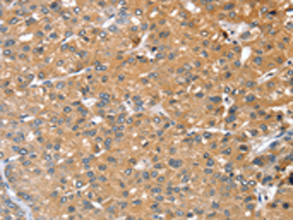 Anti-RASAL1 Rabbit Polyclonal Antibody