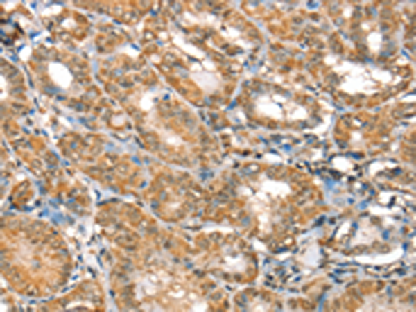 Anti-RBM5 Rabbit Polyclonal Antibody