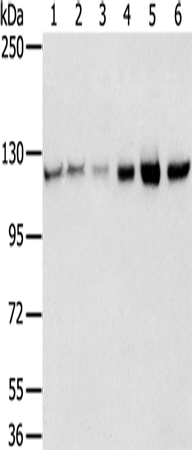 Anti-RBM5 Rabbit Polyclonal Antibody