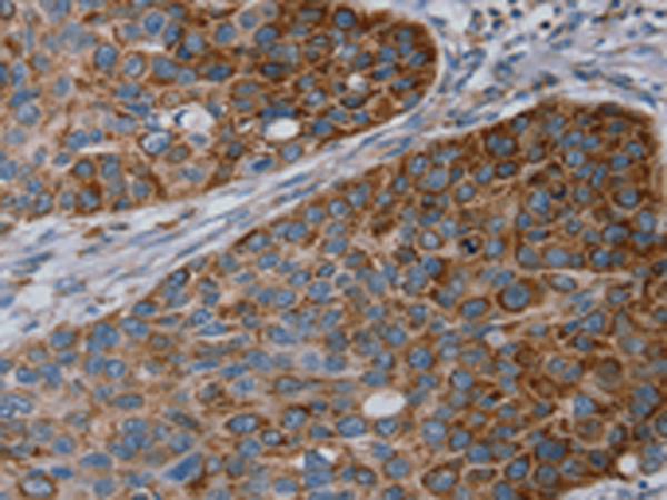 Anti-REG4 Rabbit Polyclonal Antibody