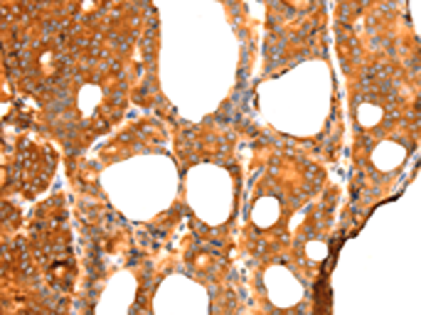 Anti-RGS5 Rabbit Polyclonal Antibody