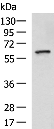 Anti-RGS14 Rabbit Polyclonal Antibody