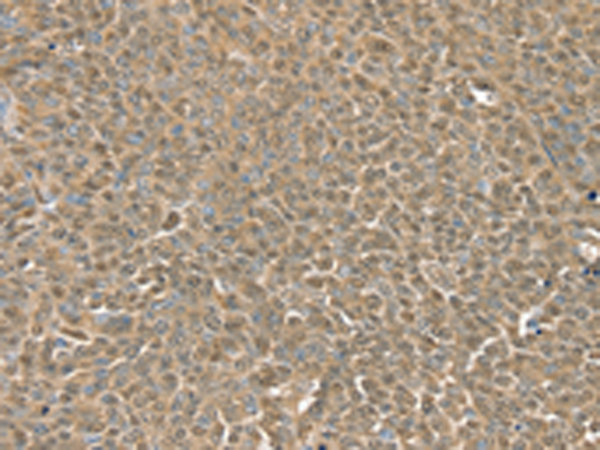 Anti-RNH1 Rabbit Polyclonal Antibody