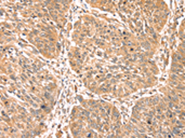 Anti-PDLIM4 Rabbit Polyclonal Antibody
