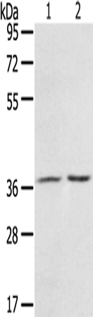 Anti-PDLIM4 Rabbit Polyclonal Antibody