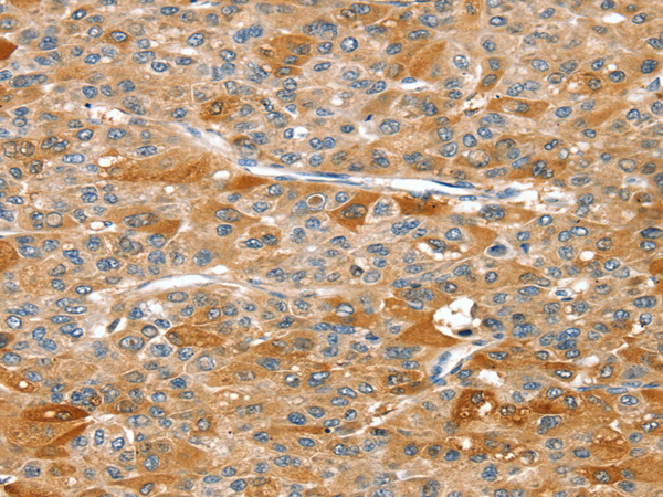 Anti-DSTYK Rabbit Polyclonal Antibody
