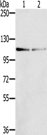 Anti-DSTYK Rabbit Polyclonal Antibody