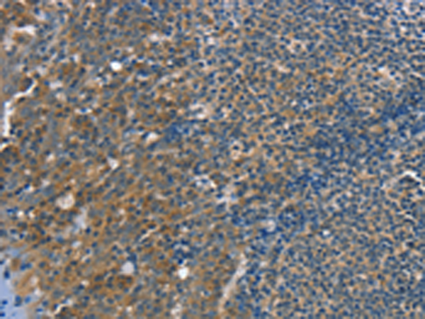 Anti-TRIM31 Rabbit Polyclonal Antibody