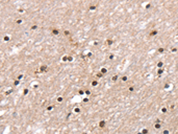Anti-RNF40 Rabbit Polyclonal Antibody