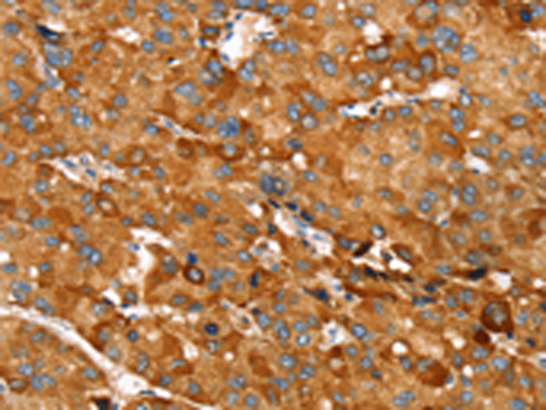 Anti-RNF14 Rabbit Polyclonal Antibody