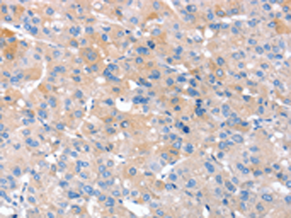 Anti-RNF214 Rabbit Polyclonal Antibody