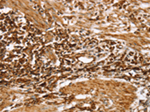 Anti-RPLP1 Rabbit Polyclonal Antibody