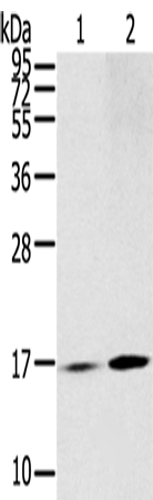 Anti-RPLP1 Rabbit Polyclonal Antibody
