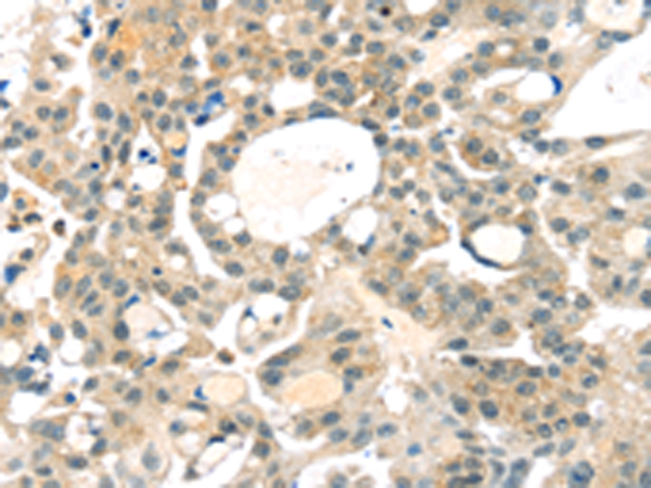 Anti-RRAGA Rabbit Polyclonal Antibody