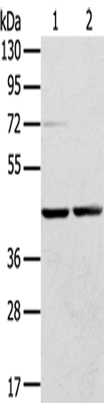 Anti-RRAGA Rabbit Polyclonal Antibody