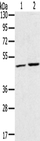 Anti-RRAGC Rabbit Polyclonal Antibody