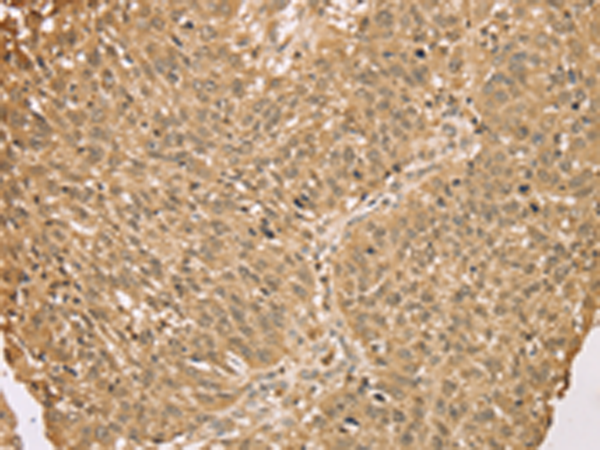 Anti-S100A11 Rabbit Polyclonal Antibody
