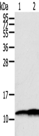 Anti-S100A11 Rabbit Polyclonal Antibody