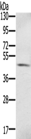 Anti-S100PBP Rabbit Polyclonal Antibody