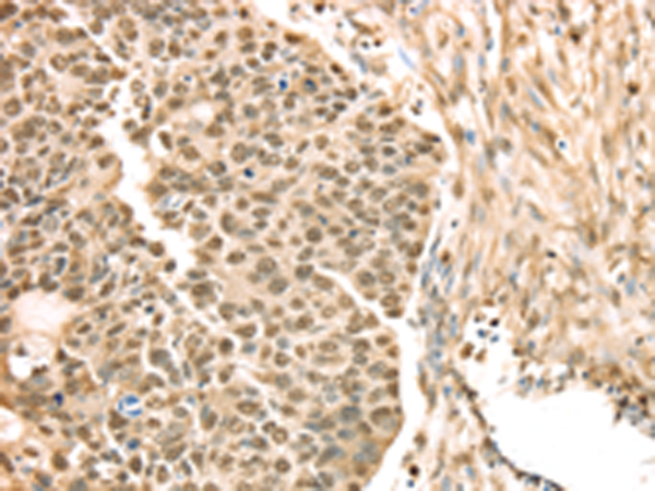 Anti-SAMD3 Rabbit Polyclonal Antibody