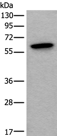 Anti-SCP2 Rabbit Polyclonal Antibody