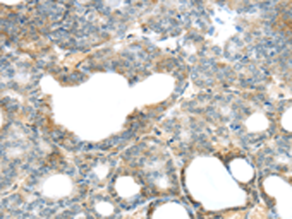 Anti-SERPINB11 Rabbit Polyclonal Antibody