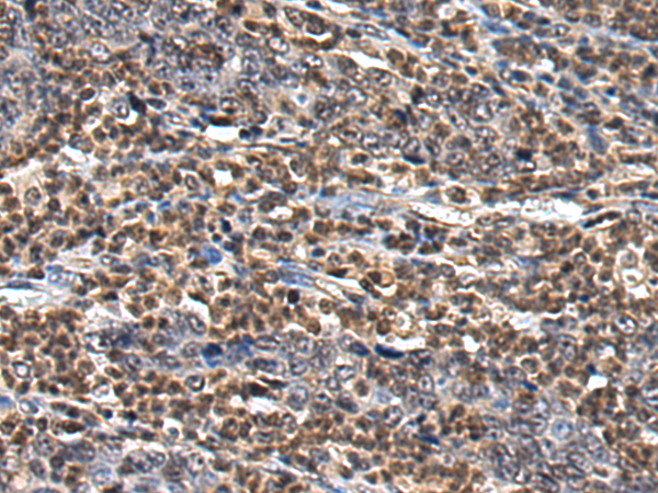 Anti-SIAH1 Rabbit Polyclonal Antibody