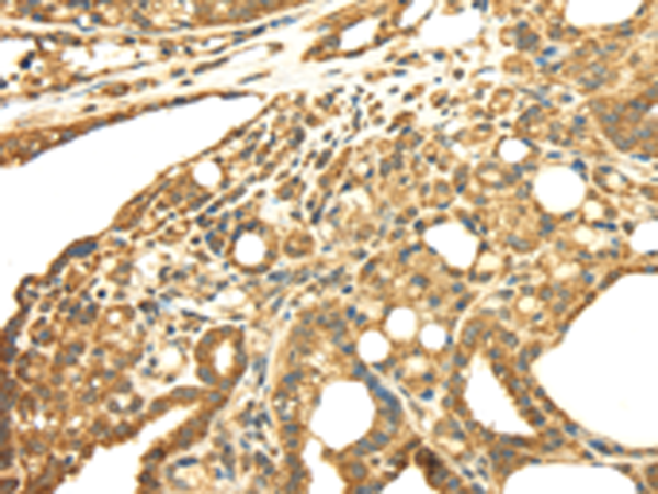 Anti-SRPRB Rabbit Polyclonal Antibody