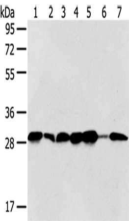 Anti-SRPRB Rabbit Polyclonal Antibody