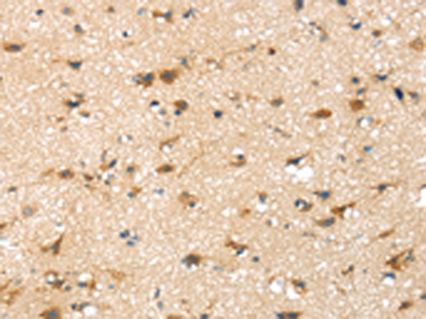 Anti-SRPX Rabbit Polyclonal Antibody