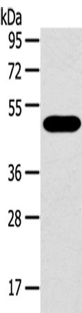 Anti-SRPX Rabbit Polyclonal Antibody