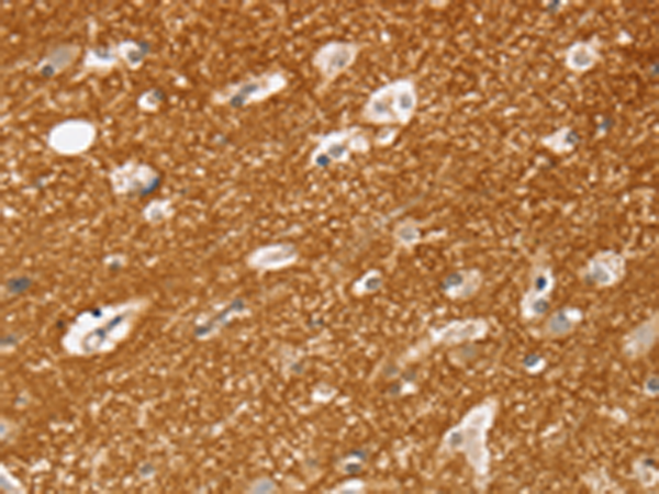 Anti-SLC25A13 Rabbit Polyclonal Antibody