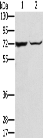 Anti-SLC25A13 Rabbit Polyclonal Antibody